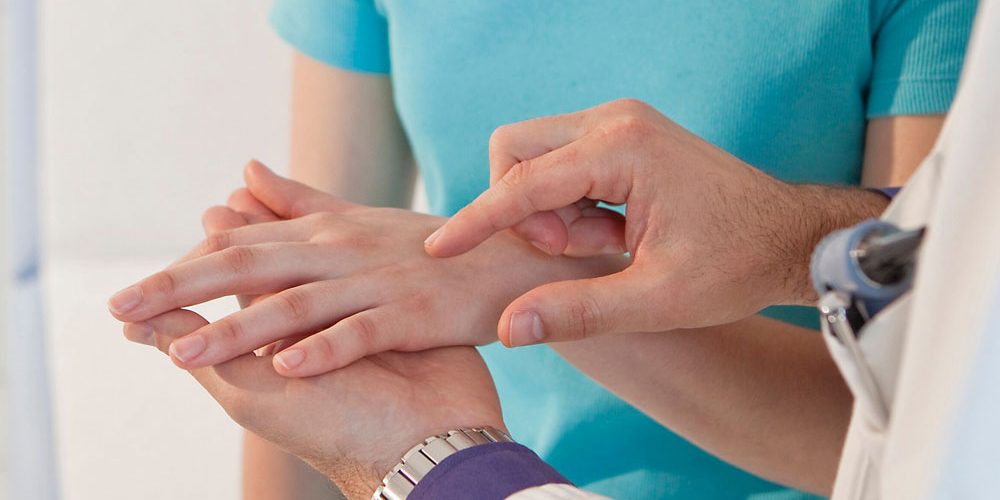 SBR-doencas-esclerodermia