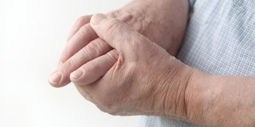 medicamento-natural-para-combater-o-reumatismo-e-distribuido-pelo-sus-e1493834977202