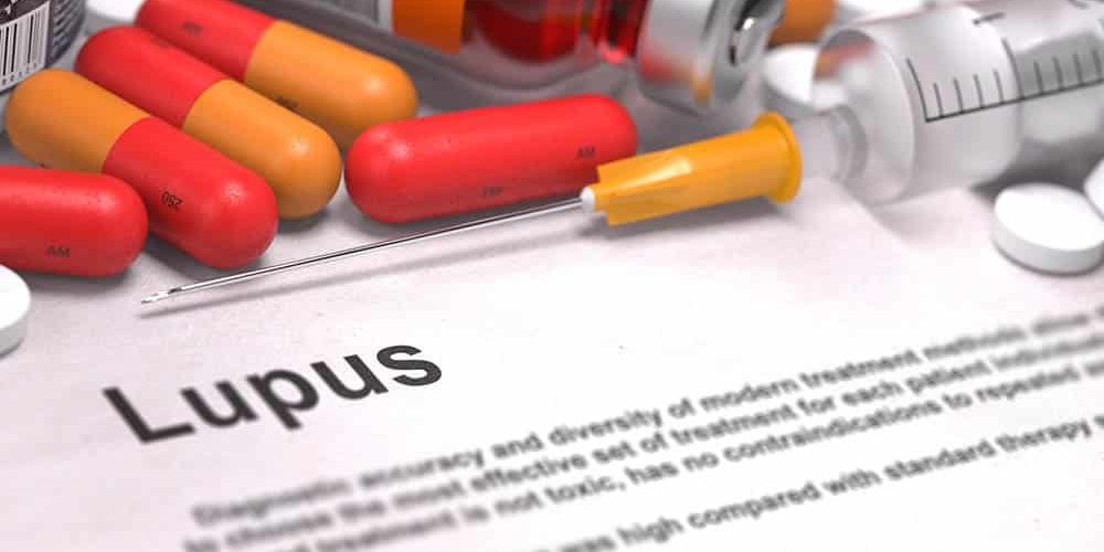 drauzio-lupus-75063569-tashatuvango-1000×563