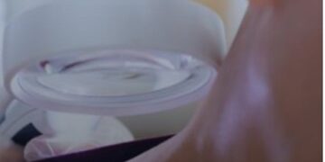 OESP_Diagnostico de Lupus no Brasil pode demorar quase uma decada