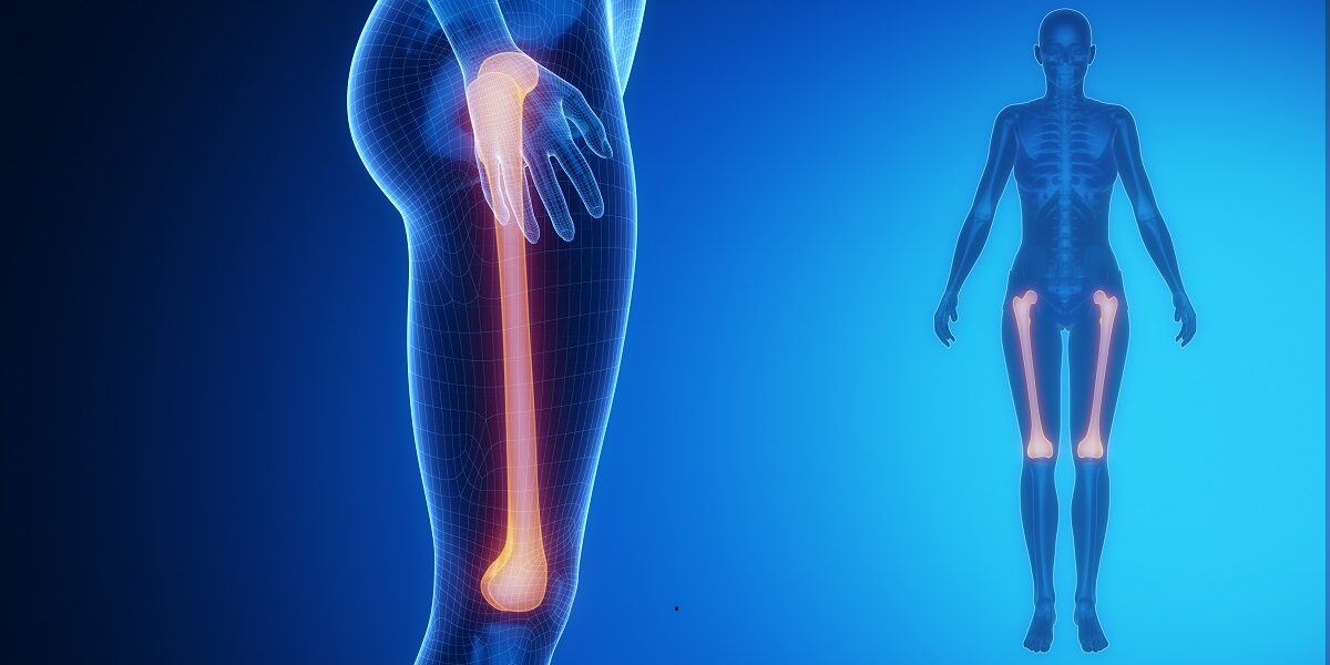 FEMUR blue x–ray bone scan